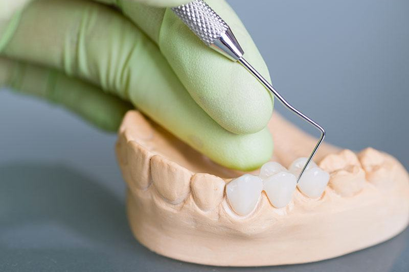 protheses fixes dentiste drummondville