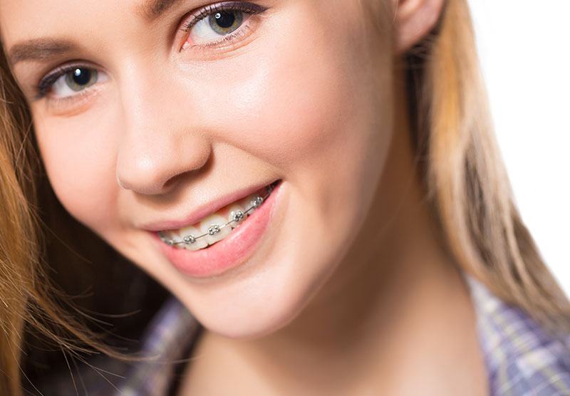 broches dentiste drummondville