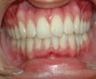 Clinique-Familiale-Dentaire-Drummondville_dentistes_4-4-Evaluation
