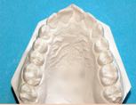 Clinique-Familiale-Dentaire-Drummondville_dentistes_4-5-Evaluation